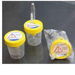 CONTENITORE PER URINA DA 120ML TAPPO A VITE CON DISPOSITIVO DI PRELIEVO DA PROVETTA SOTTOVUOTO IN POLIPROPILE
